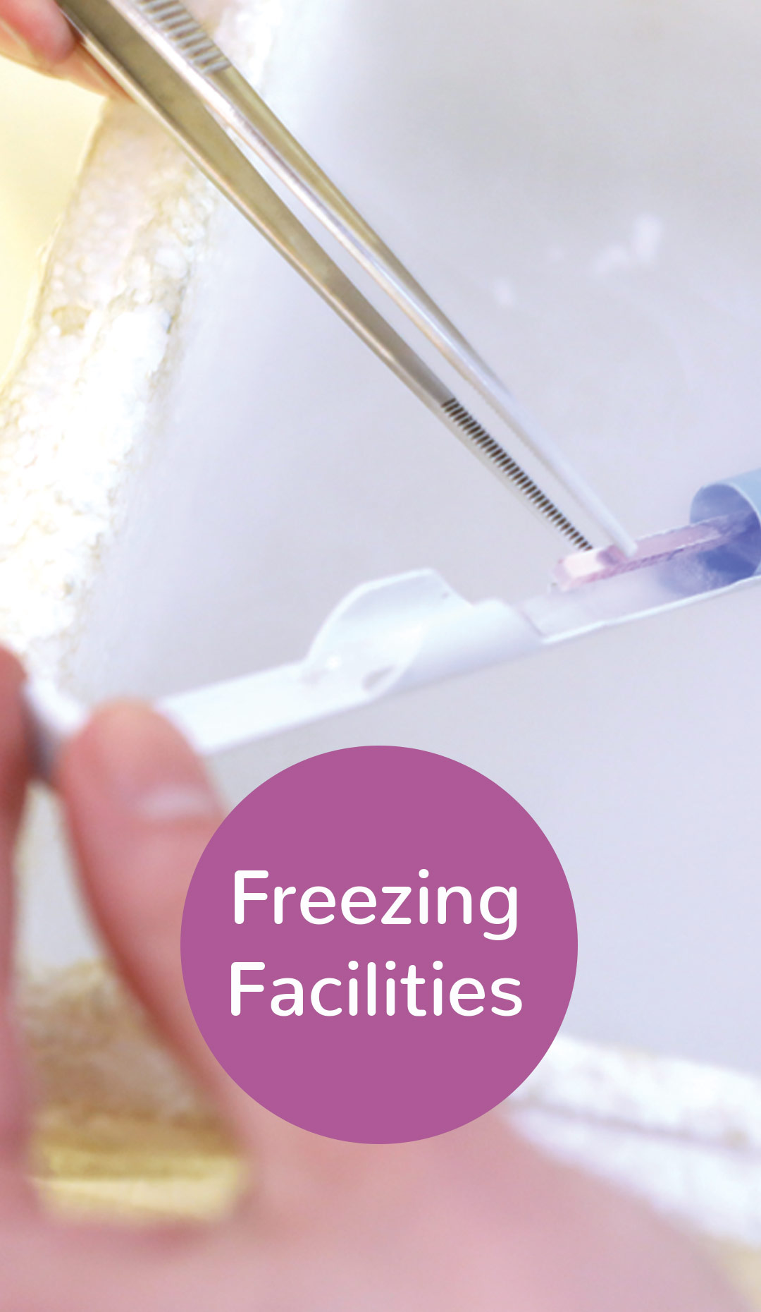 Oocyte and Sperm Freezing Servicesin Hyderabad